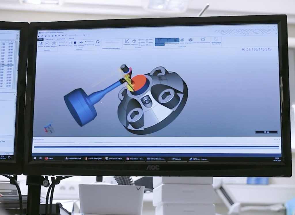 CAD/CAM-Konstruktion eines Implantatgerüsts am Bildschirm